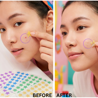 Star Perfections - Star Acne Patches